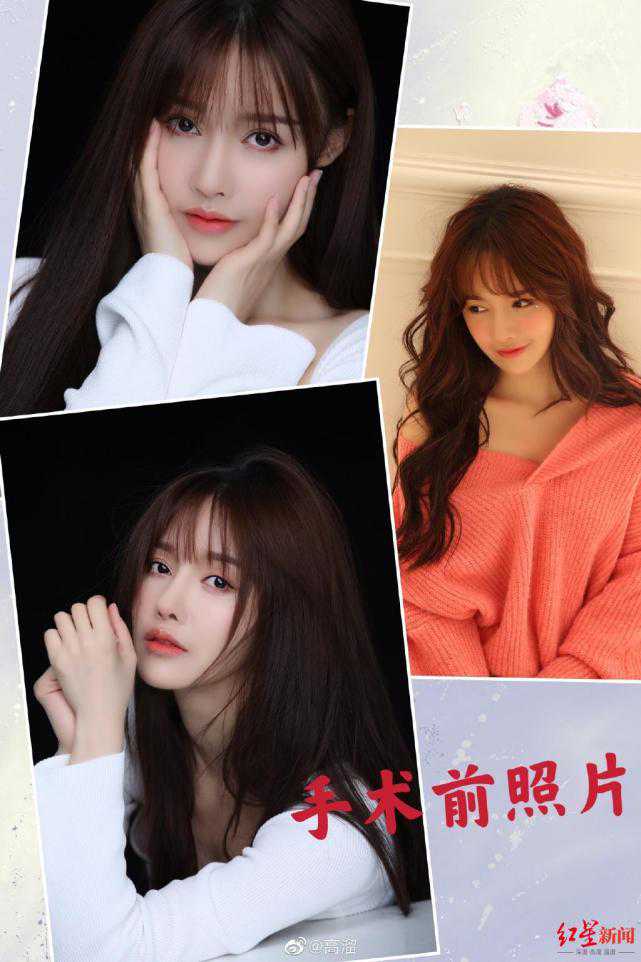 演员高溜自曝整形致鼻子坏死，涉事医美机构8个月曾遭5次行政处罚